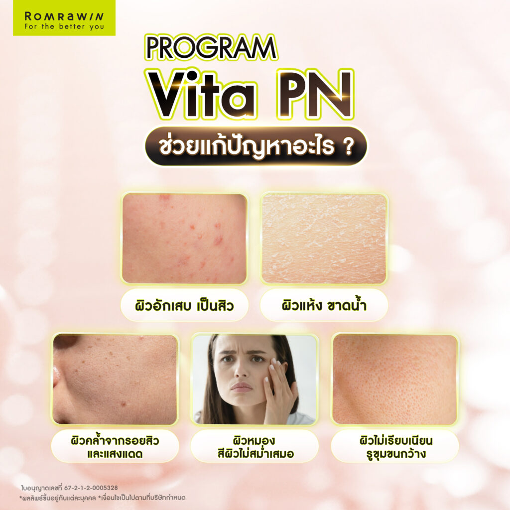 ข้อดีของ Vitaran I คืออะไร? ช่วยแก้ปัญหาอะไร? ทำไมถึงควรฉีด? 4 Vitaran I ช่วยแก้ปัญหาอะไร?