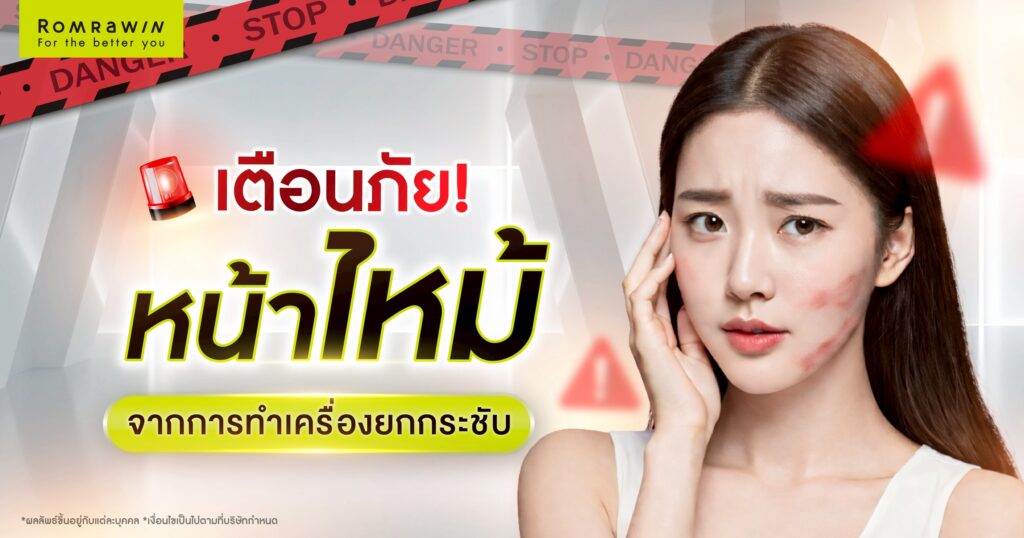 เตือนภัย หน้าไหม้