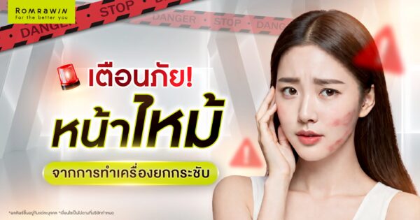 เตือนภัย หน้าไหม้