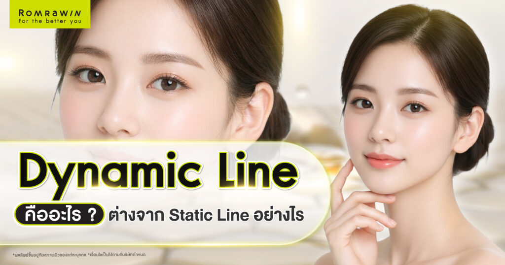 Dynamic Line คืออะไร ต่างจาก Static Line อย่างไรในเชิงโครงสร้างผิว 1 Dynamic Line คืออะไร ต่างจาก Static Line อย่างไร