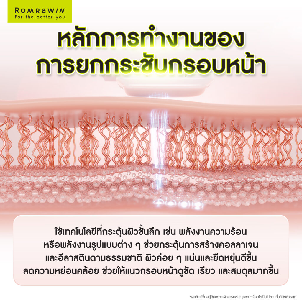 กรอบหน้าดูคมชัด เรียวขึ้น ด้วยวิธียกกระชับกรอบหน้าที่เหมาะสม 3 หลักการทำงานของการยกกระชับกรอบหน้า