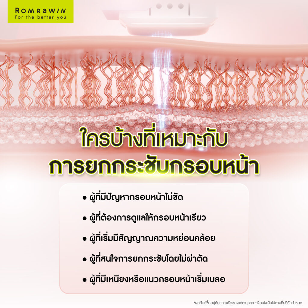 กรอบหน้าดูคมชัด เรียวขึ้น ด้วยวิธียกกระชับกรอบหน้าที่เหมาะสม 6 ใครบ้างที่เหมาะกับการยกกระชับกรอบหน้า