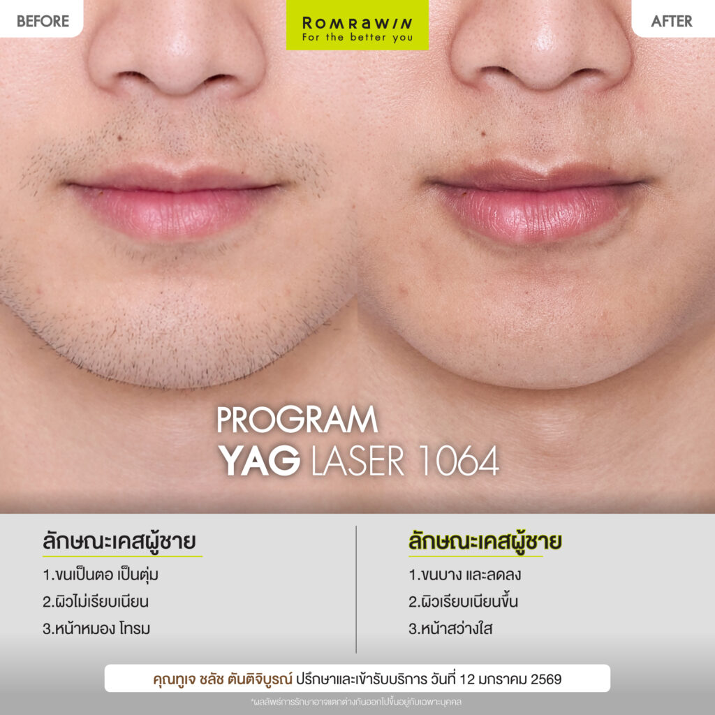 ผลลัพธ์ขึ้นอยู่กับแต่ละบุคคล