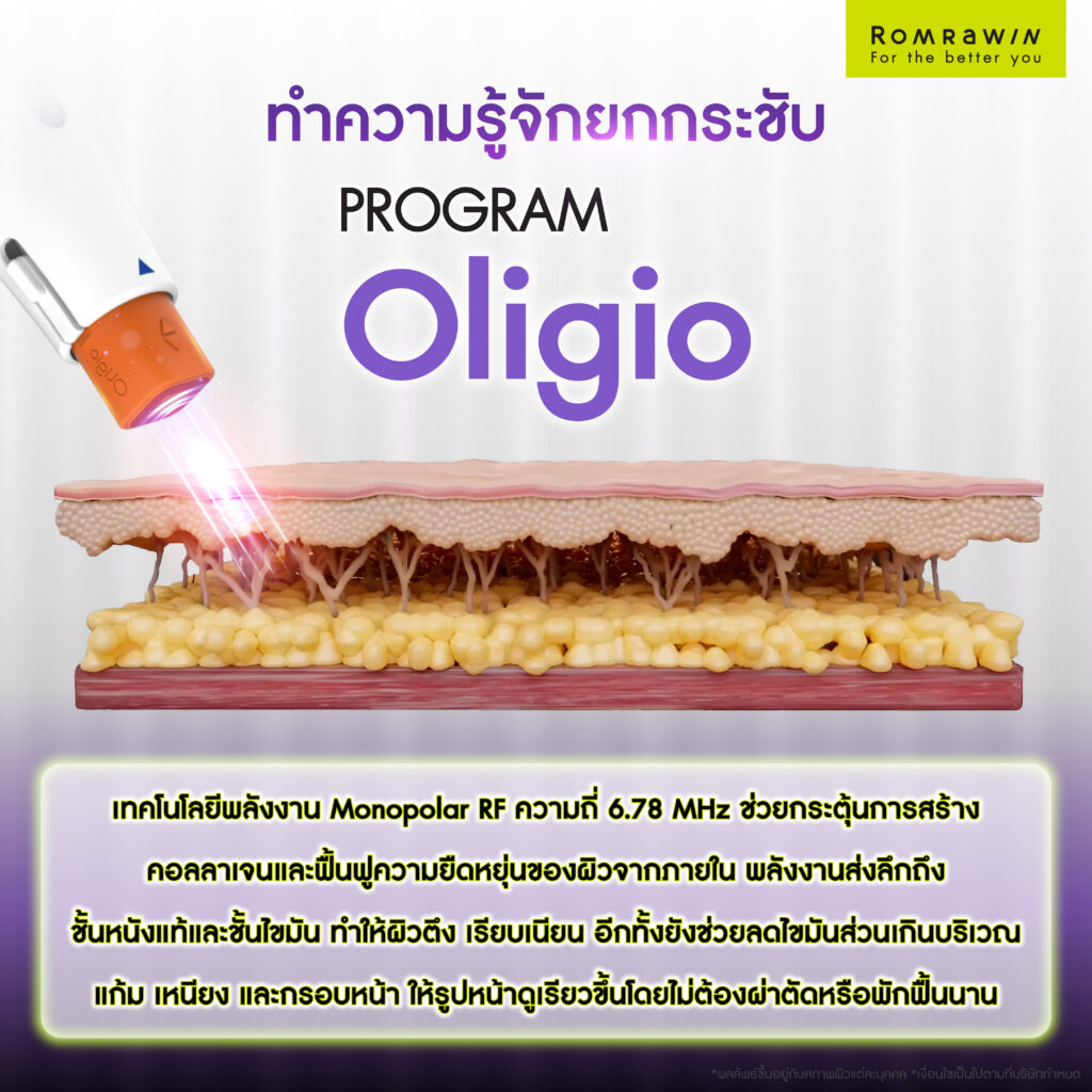 ทำความรู้จักยกกระชับ Oligio เทคโนโลยีเพื่อการยกกระชับผิว