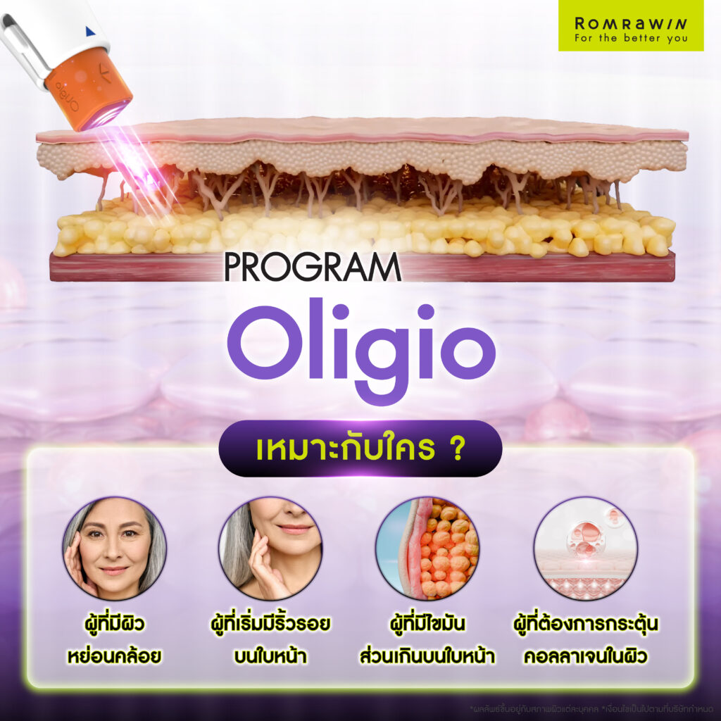 ยกกระชับ Oligio เหมาะกับใครบ้าง?