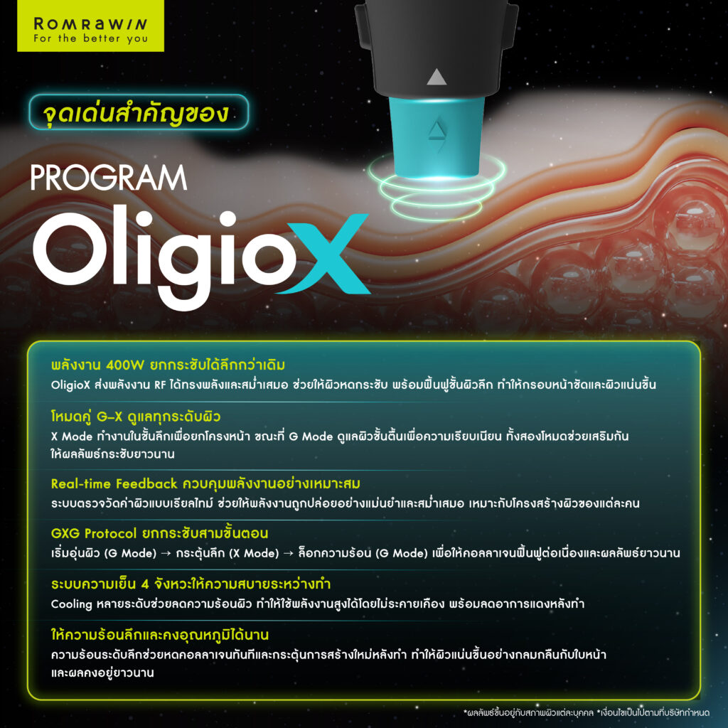 ทำความรู้จัก OligioX คืออะไร เทคโนโลยียกกระชับผิวที่พัฒนาจาก Oligio สู่ผลลัพธ์ที่ลงลึกกว่า 5 จุดเด่นสำคัญของ OligioX เทคโนโลยียกกระชับผิวในระดับลึก