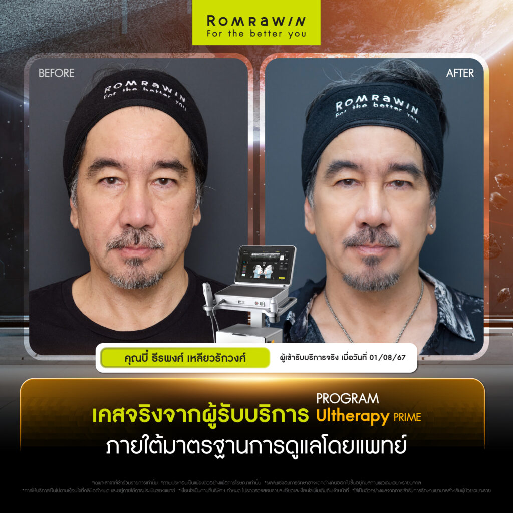 "คุณบี๋ - ธีรพงศ์ เหลียวรักวงศ์" เคสจริงจากผู้ใช้บริการจริง