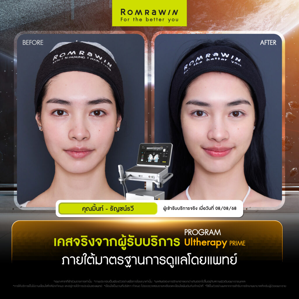 "คุณมิ้นท์ - ธัญชน์รวี" เคสจริงจากผู้ใช้บริการจริง