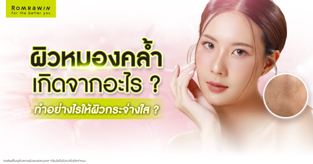 ผิวหมองคล้ำ สีผิวไม่สม่ำเสมอเกิดจากอะไร