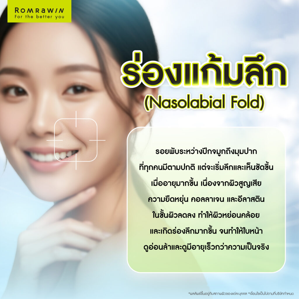 ร่องแก้มลึกคืออะไร? ทำไมต้องรีบแก้ร่องแก้มลึกตั้งแต่เริ่มเห็นสัญญาณ