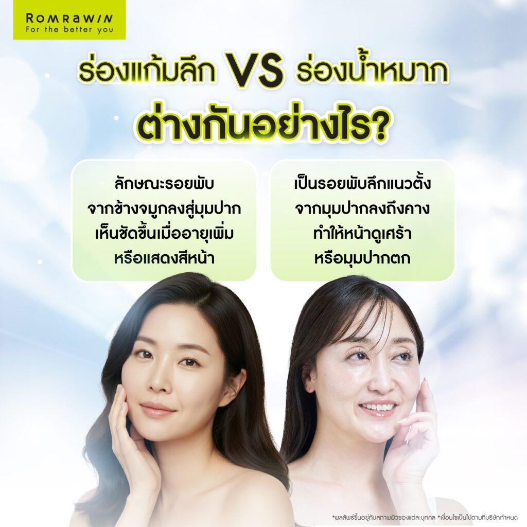 ร่องแก้มลึก vs ร่องน้ำหมาก ต่างกันอย่างไร? 