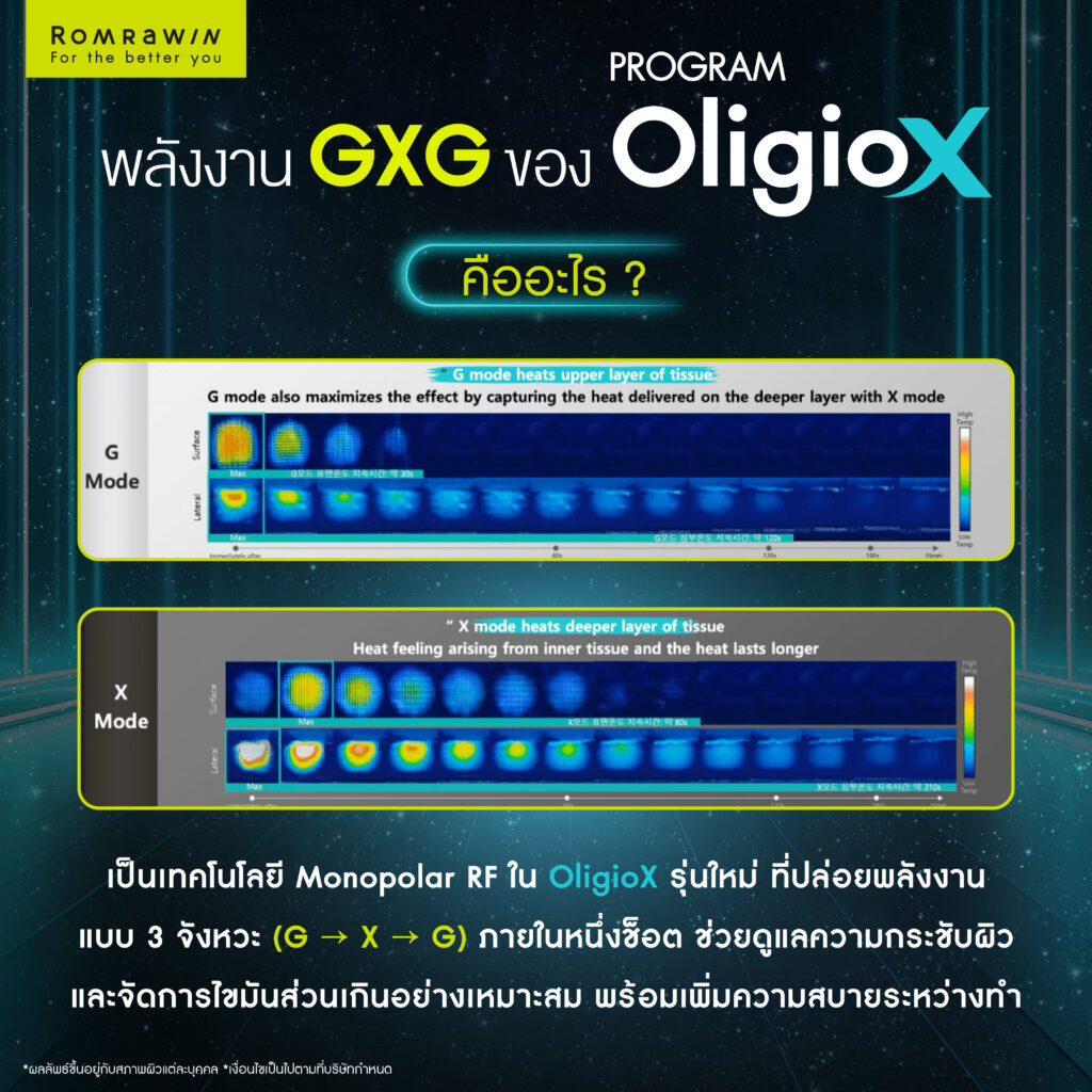 พลังงาน GXG ของ OligioX ทำงานกับผิวอย่างไร? เจาะลึกเบื้องหลังเทคโนโลยีที่ช่วยให้ผิวดูแน่นขึ้น 4 พลังงาน GXG ของ OligioX คืออะไร