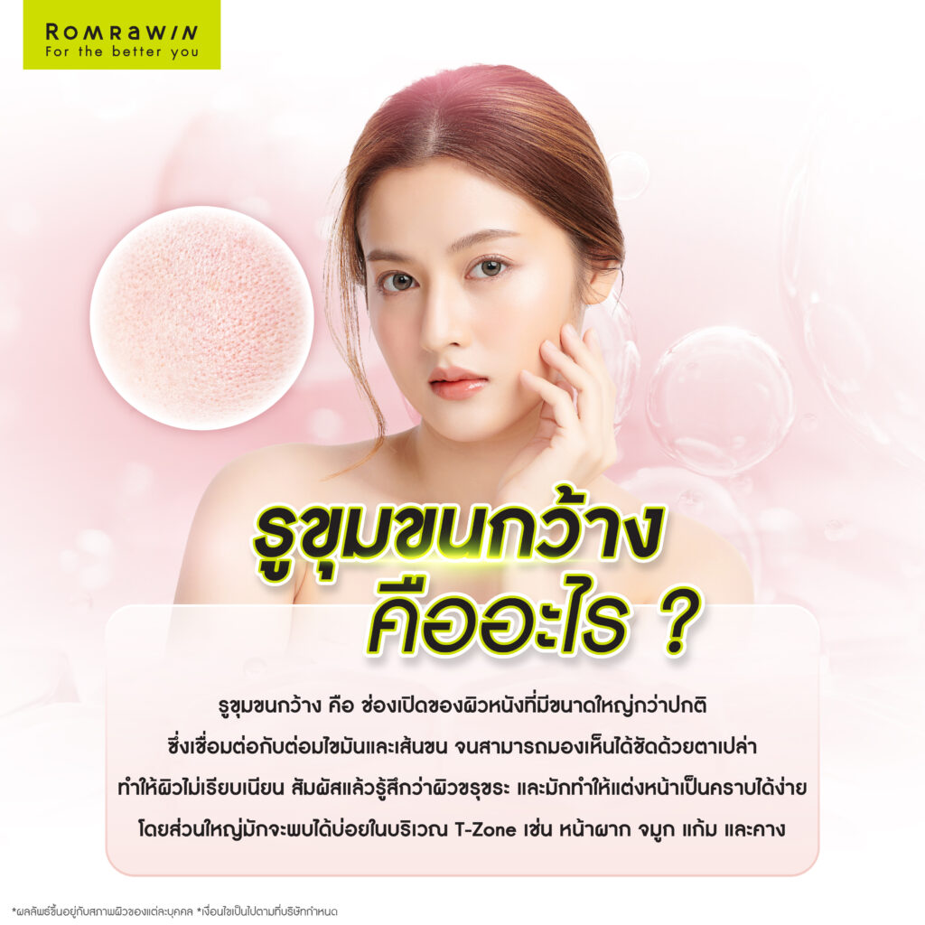 รู้จัก รูขุมขนกว้าง คืออะไร?