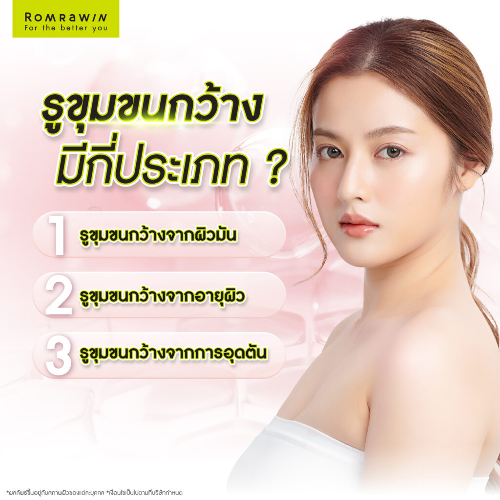 ประเภทของรูขุมขนกว้าง