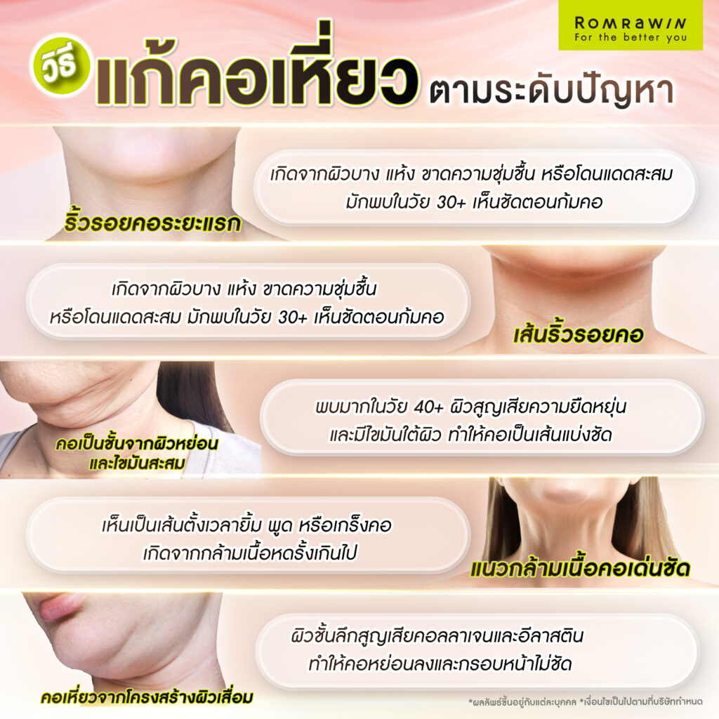 วิธีแก้คอเหี่ยวตามระดับปัญหา เข้าใจความแตกต่างของคอเหี่ยวย่น