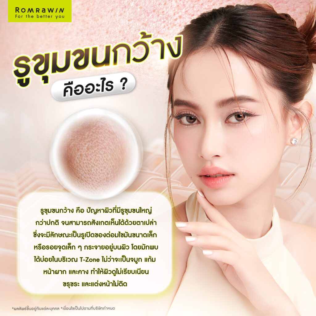 รูขุมขนกว้าง คืออะไร