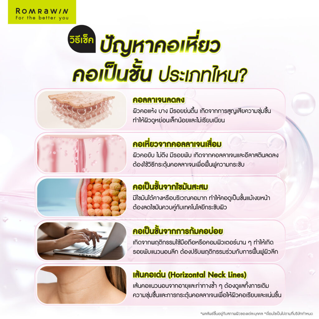 วิธีเช็กว่าคุณมีปัญหาคอเหี่ยว คอเป็นชั้นประเภทไหน?