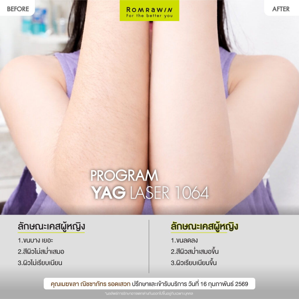 ผลลัพธ์ขึ้นอยู่กับแต่ละบุคคล