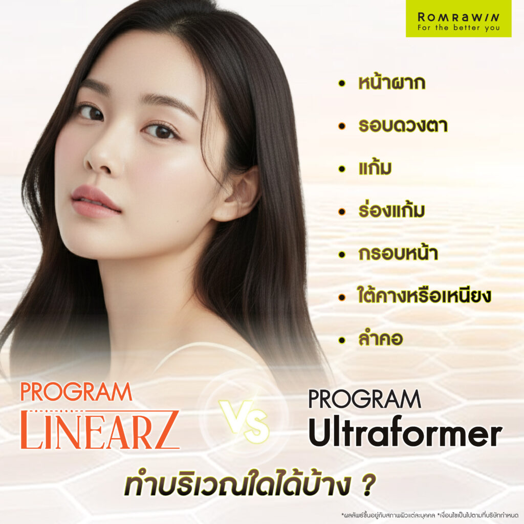 LinearZ กับ Ultraformer สามารถทำบริเวณไหนได้บ้าง?