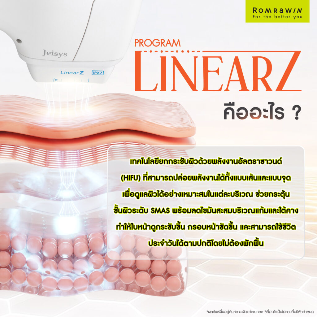 LinearZ คืออะไร