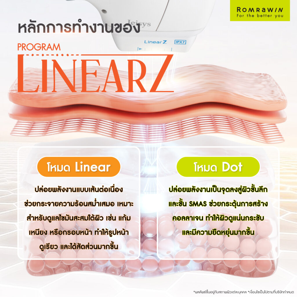 หลักการทำงานของ LinearZ