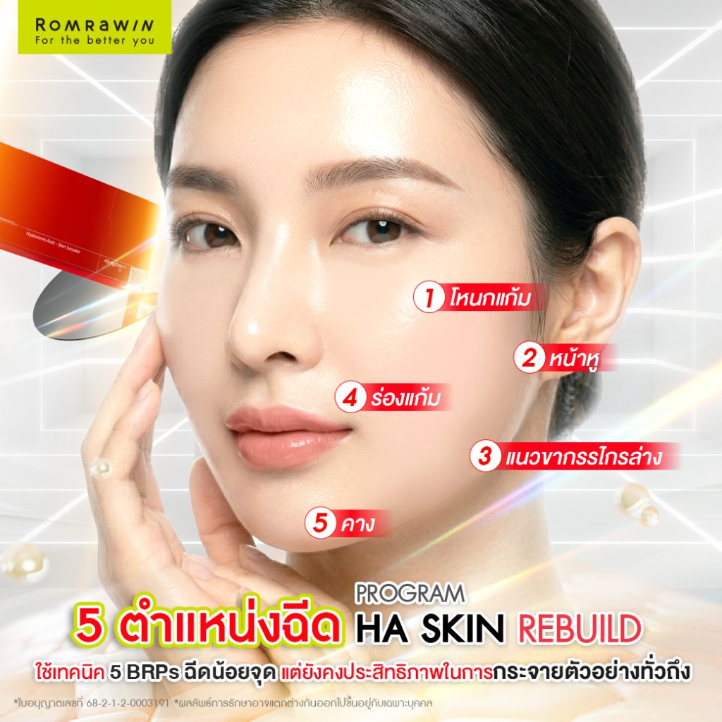 Ejal40 กับการฟื้นฟูโครงสร้างผิว สนับสนุนความแข็งแรงของผิวในระยะยาว 6 เทคนิคการฉีด Ejal40 แบบ 5 BRPs (5 Points Technique)