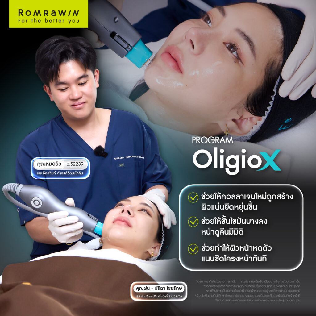 ยกกระชับหน้าแบบคุณฝนกับ Oligio X เย็นสบาย ผิวตึง กรอบหน้าชัดขึ้น 2 ยกกระชับหน้าแบบคุณฝนกับ Oligio X เย็นสบาย ผิวตึง กรอบหน้าชัดขึ้น