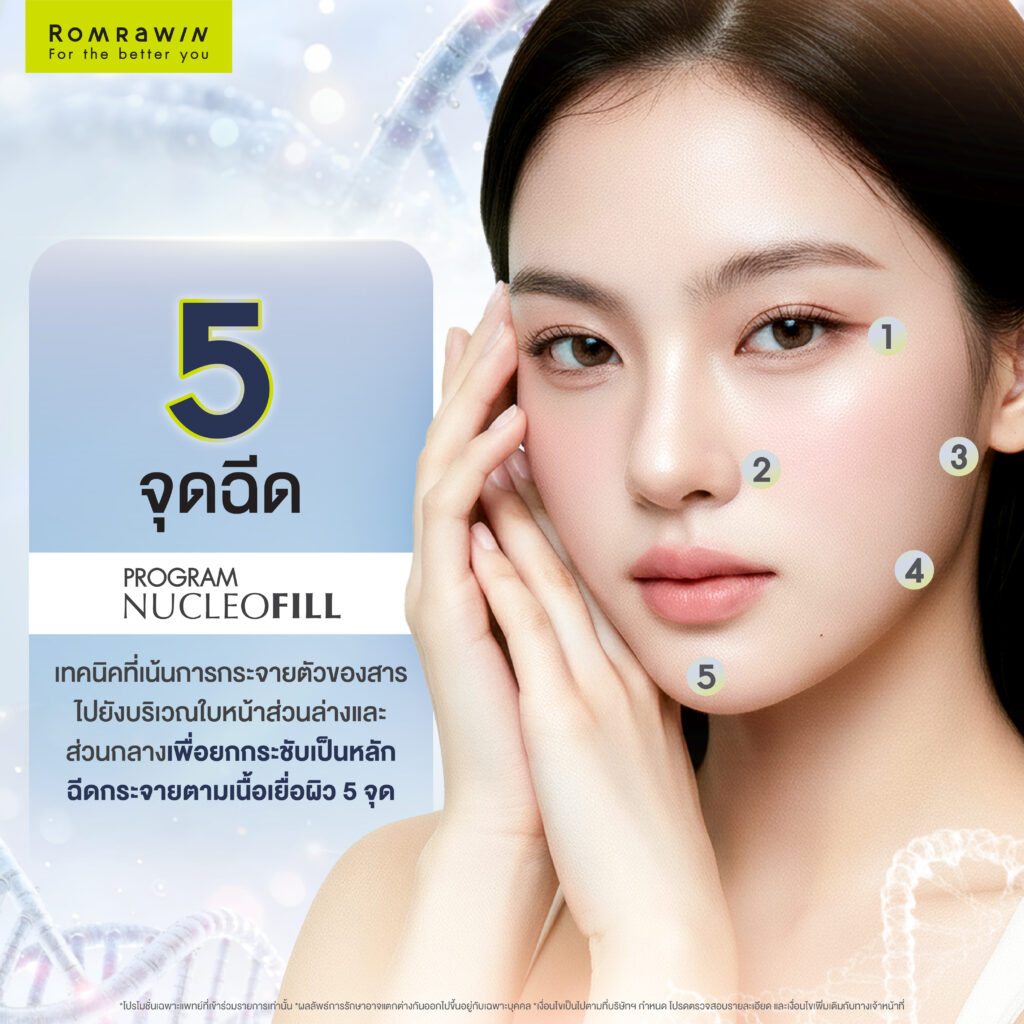 5 จุดฉีดโปรแกรม Nucleofill Strong