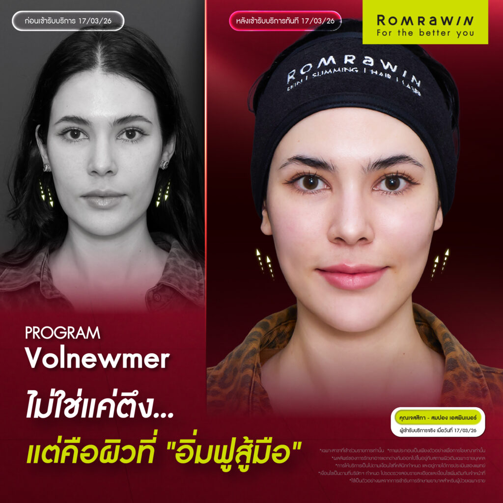 ผลลัพธ์ขึ้นอยู่กับแต่ละบุคคล