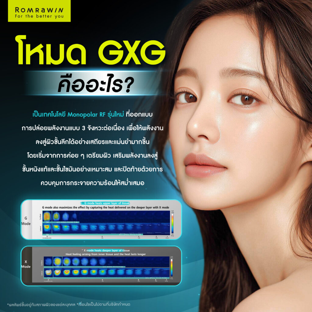 โหมด GXG คืออะไร?