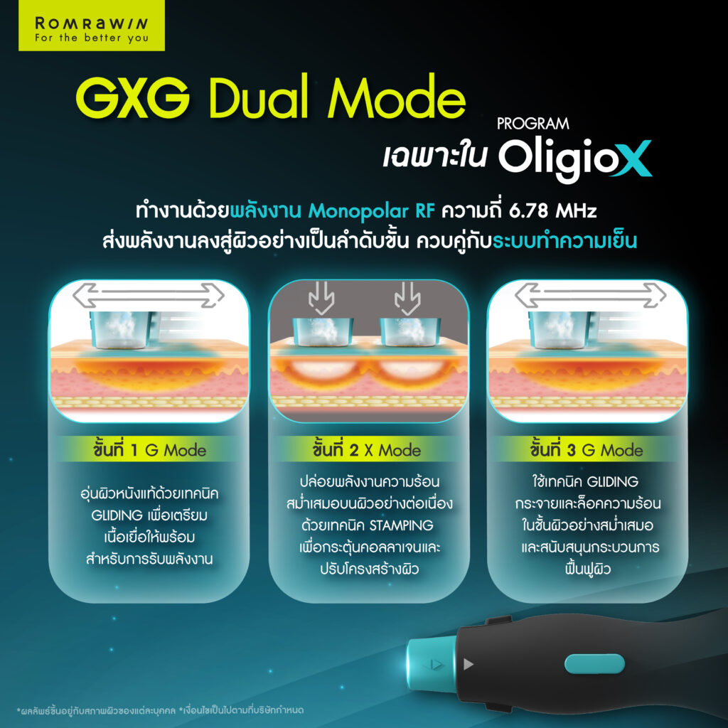 หลักการทำงานของโหมด GXG ใน OligioX