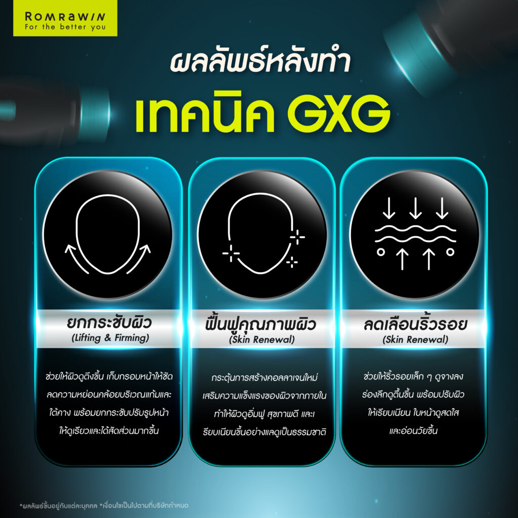 เทคนิค GXG ใน Oligio X ทำไมแตกต่างจาก RF แบบเดิม 5 ผลลัพธ์หลังทำเทคนิค GXG ใน Oligio X