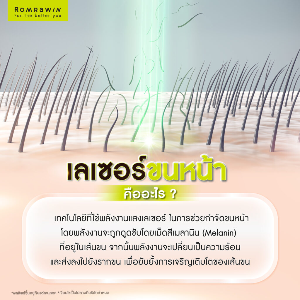 เลเซอร์ขนหน้า ทางเลือกกำจัดขนหน้าเพื่อผิวเรียบเนียน 3 เลเซอร์ขนหน้าคืออะไร? ทำงานอย่างไร?