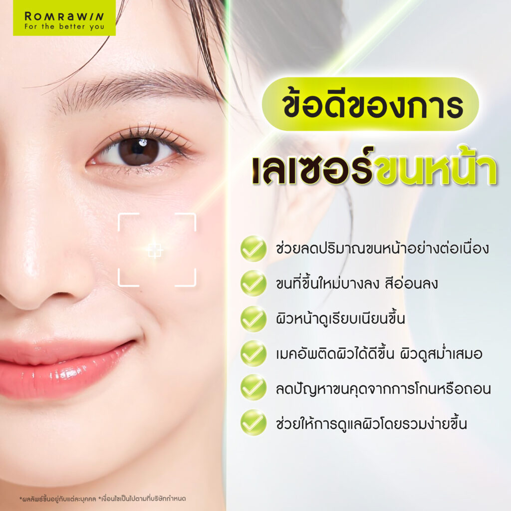 เลเซอร์ขนหน้า ทางเลือกกำจัดขนหน้าเพื่อผิวเรียบเนียน 4 ข้อดีของการเลเซอร์ขนหน้า