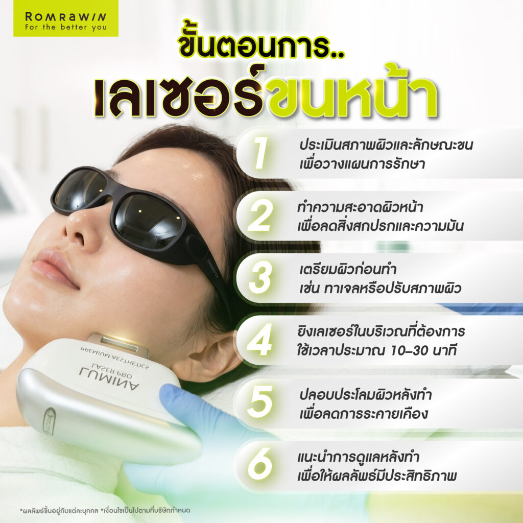 เลเซอร์ขนหน้า ทางเลือกกำจัดขนหน้าเพื่อผิวเรียบเนียน 6 ขั้นตอนการเลเซอร์ขนหน้า