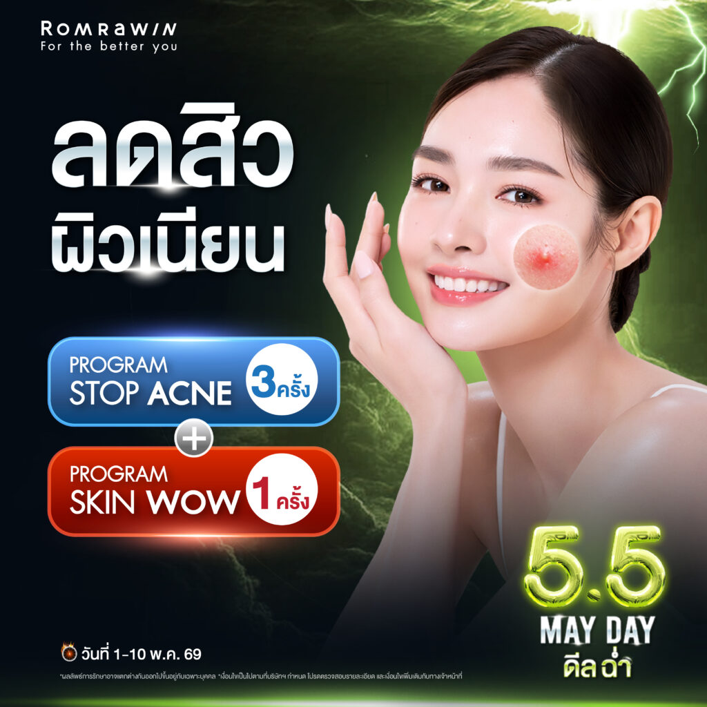 5.5 May Day..หยุดสิว ผิวเนียน