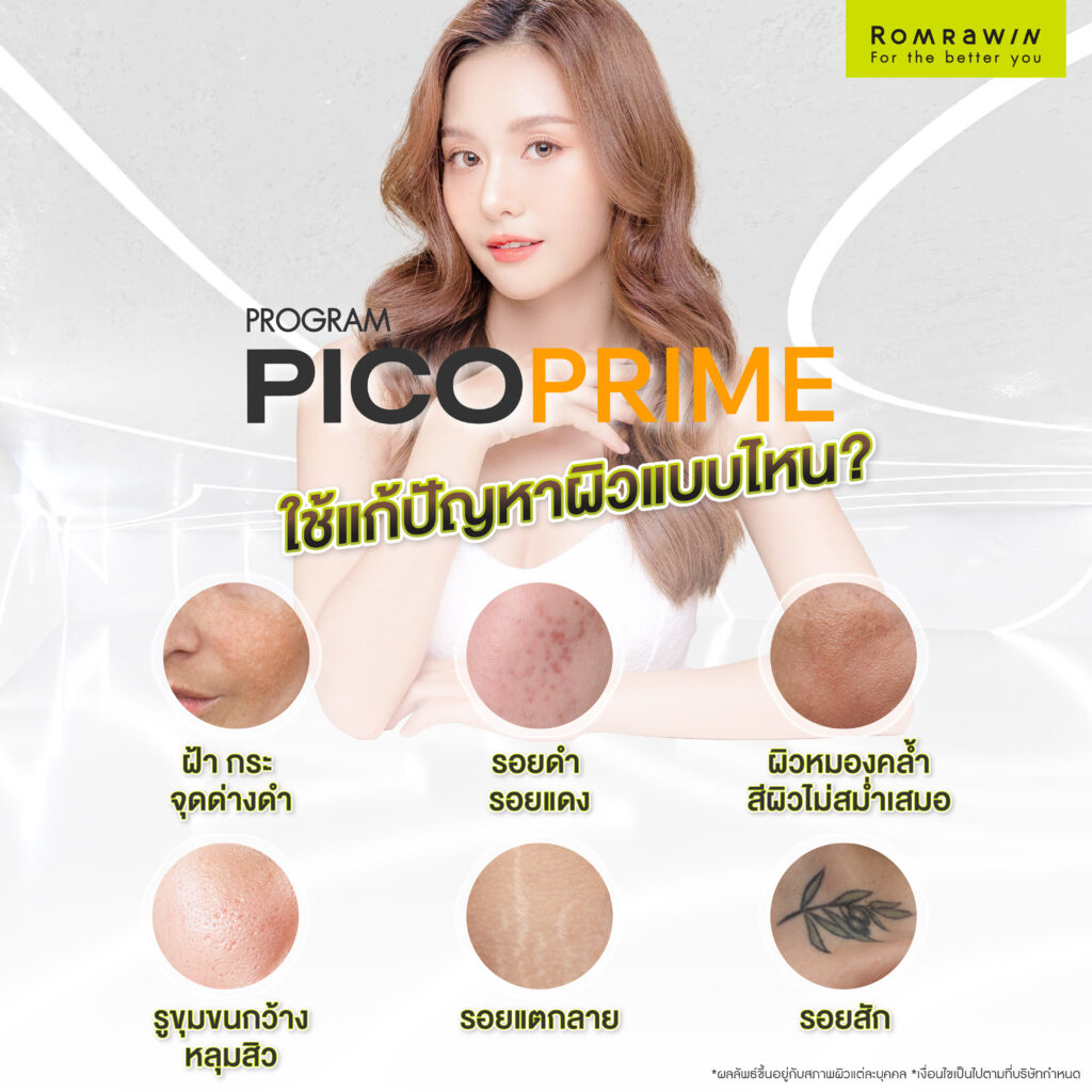 Pico Prime คืออะไร? เจาะลึกเลเซอร์ลบฝ้า กระ จุดด่างดำ และรอยสัก 4 Pico Prime ใช้แก้ปัญหาผิวประเภทไหน?
