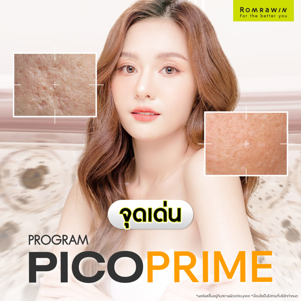 Pico Prime คืออะไร? เจาะลึกเลเซอร์ลบฝ้า กระ จุดด่างดำ และรอยสัก 3 จุดเด่นของ Pico prime