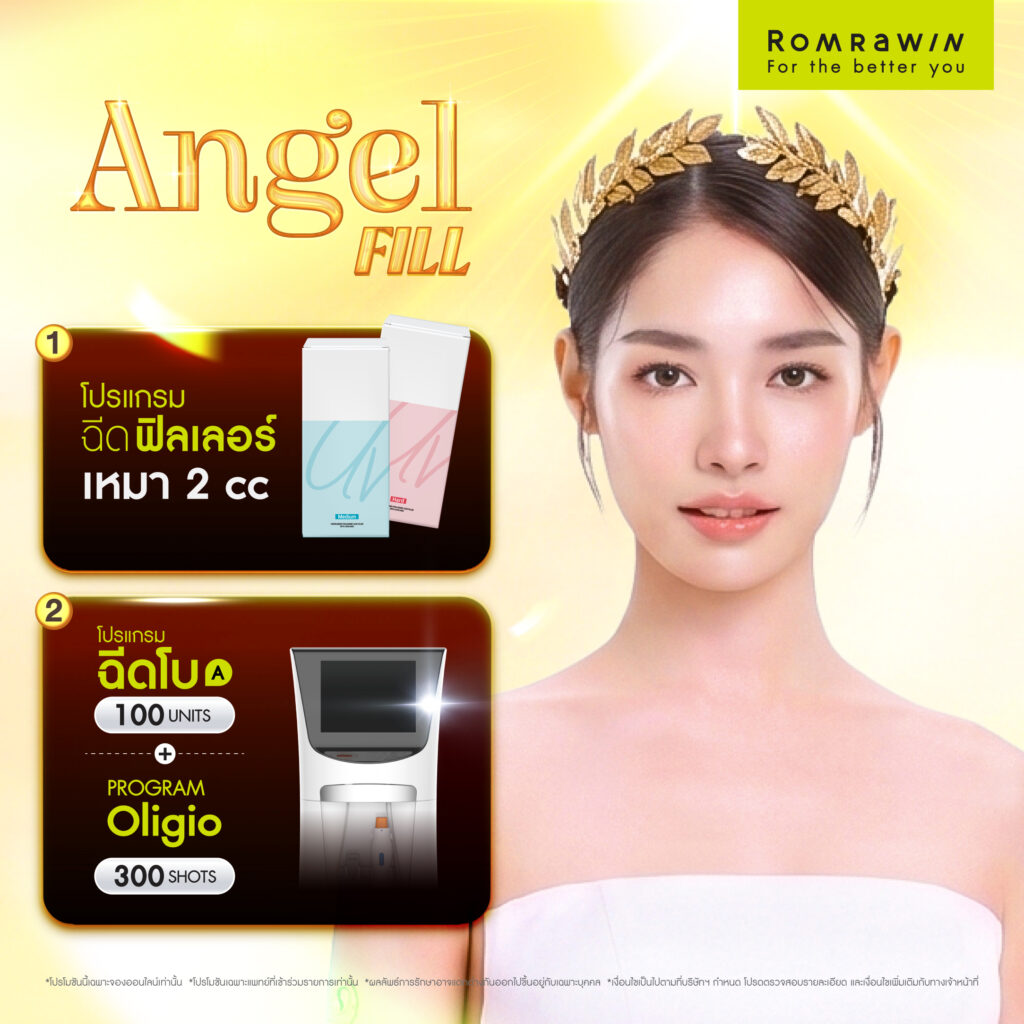 Angel Deal Fill