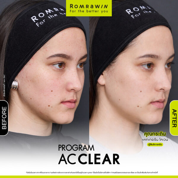 AC CLEAR