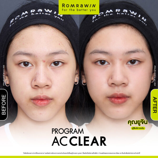 AC CLEAR