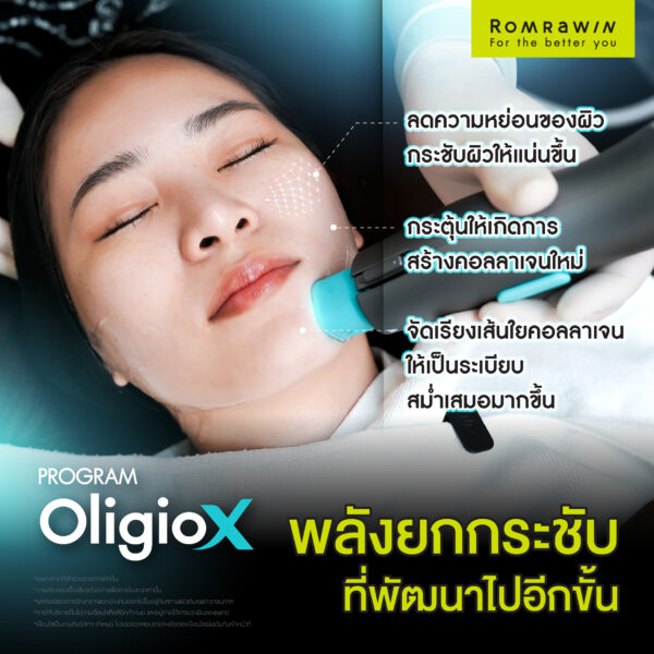 G Mode เทคโนโลยีสร้างงานผิว ใน Oligio X เพื่อผลลัพธ์ที่ดีกว่า 6 G mode แอ๊ปเปิ้ล