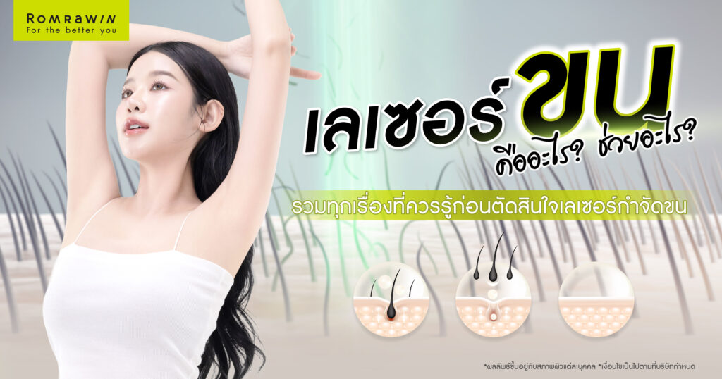 เลเซอร์ขน คืออะไร? ช่วยอะไร รวมทุกเรื่องที่ควรรู้ก่อนตัดสินใจเลเซอร์กำจัดขน 1 เลเซอร์ขน คืออะไร? ช่วยอะไร รวมทุกเรื่องที่ควรรู้ก่อนตัดสินใจเลเซอร์กำจัดขน