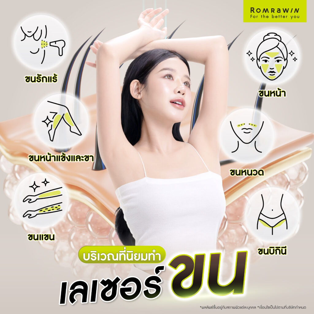 เลเซอร์ขน คืออะไร? ช่วยอะไร รวมทุกเรื่องที่ควรรู้ก่อนตัดสินใจเลเซอร์กำจัดขน 4 บริเวณที่นิยมทำเลเซอร์ขน
