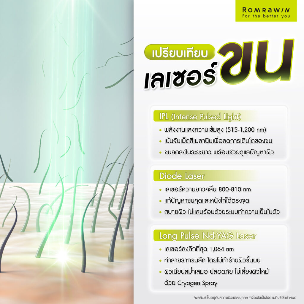 เลเซอร์ขน คืออะไร? ช่วยอะไร รวมทุกเรื่องที่ควรรู้ก่อนตัดสินใจเลเซอร์กำจัดขน 5 เปรียบเทียบเลเซอร์ขน IPL, Diode Laser และ Long Pulse Nd:YAG