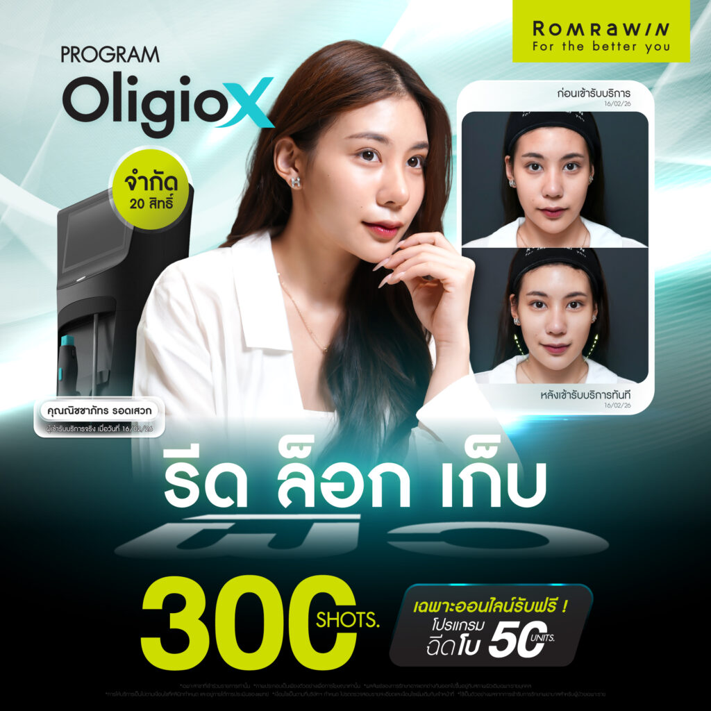 G Mode เทคโนโลยีสร้างงานผิว ใน Oligio X เพื่อผลลัพธ์ที่ดีกว่า 8 Oligio X G Mode