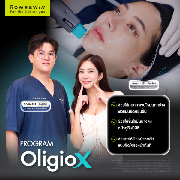 G Mode เทคโนโลยีสร้างงานผิว ใน Oligio X เพื่อผลลัพธ์ที่ดีกว่า 2 Oligio X G Mode