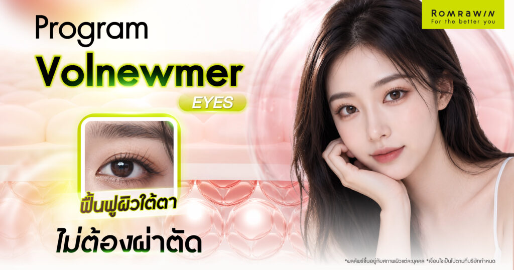 Volnewmer Eyes หัวทิป 0.25 ลดริ้วรอย ยกกระชับรอบดวงตาโดยไม่ต้องผ่าตัด 1 Volnewmer Eyes หัวทิป 0.25