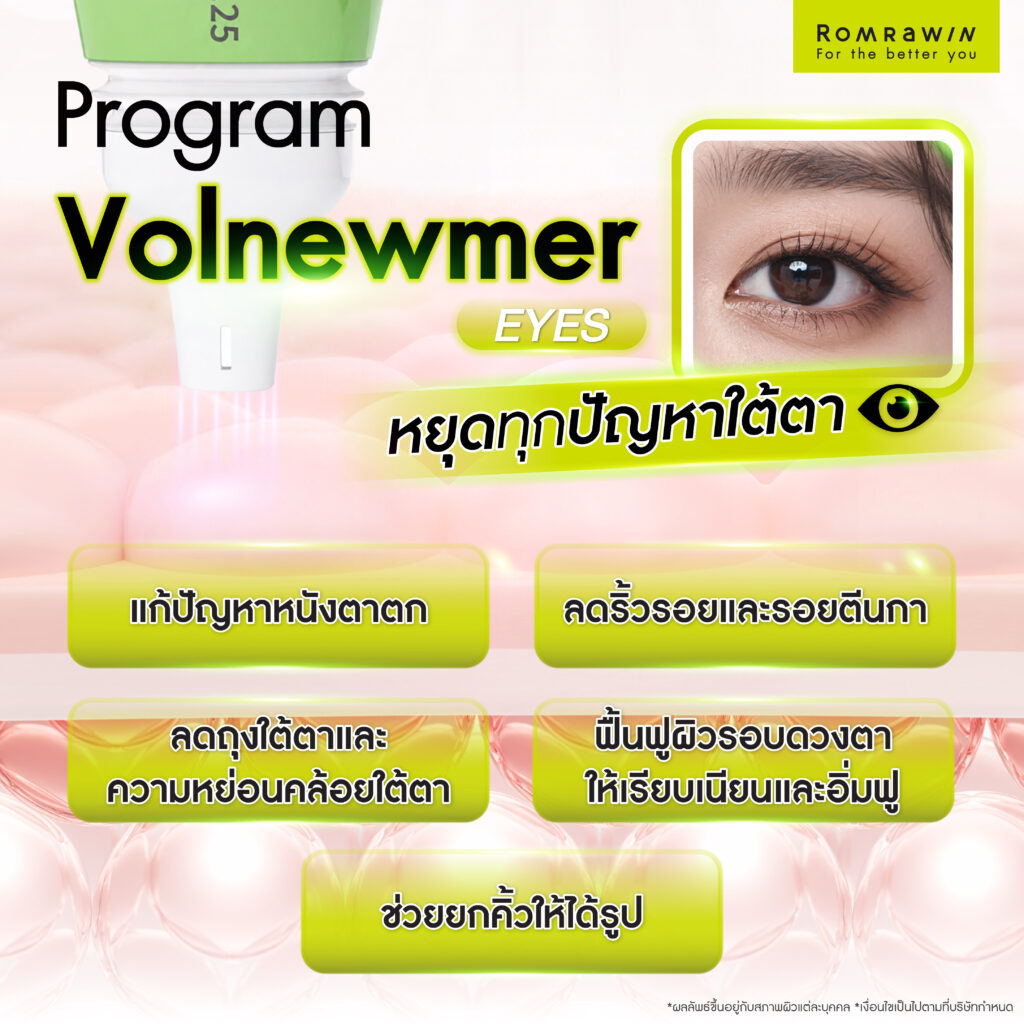 Volnewmer Eyes หัวทิป 0.25 ลดริ้วรอย ยกกระชับรอบดวงตาโดยไม่ต้องผ่าตัด 5 ข้อดีของ Volnewmer Eyes