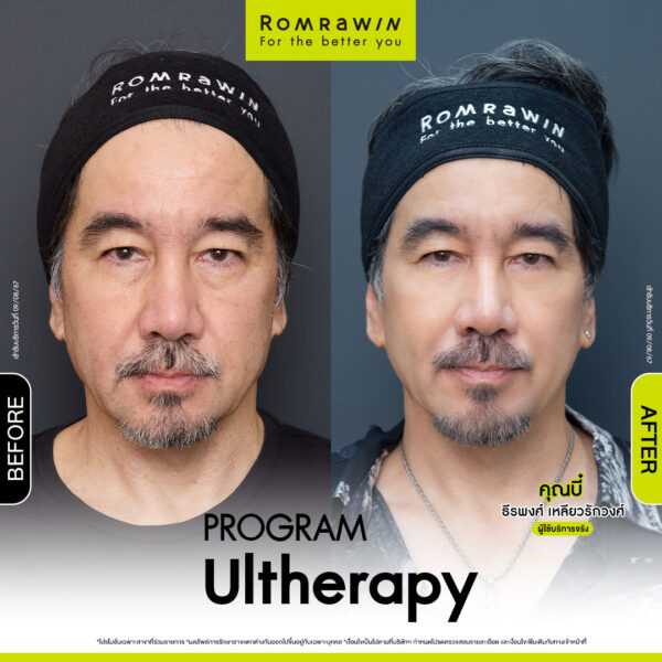 รีวิว อัลเทอร่า คุณบี๋